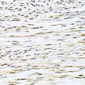 Anti-KU70 antibody produced in rabbit