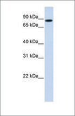Anti-STAT5B (ab2) antibody produced in rabbit affinity isolated antibody