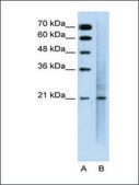 Anti-MUC1 affinity isolated antibody