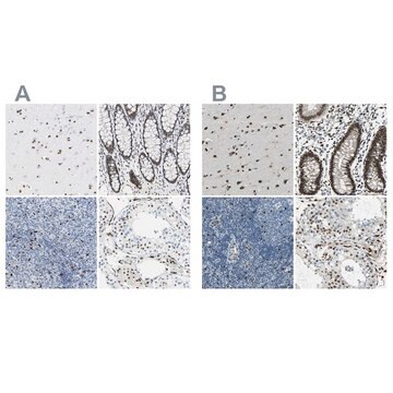 Anti-NFIA antibody produced in rabbit Prestige Antibodies® Powered by Atlas Antibodies, affinity isolated antibody, buffered aqueous glycerol solution