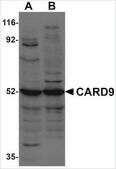 Anti-CARD9 antibody produced in rabbit affinity isolated antibody, buffered aqueous solution