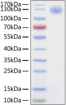 Recombinant 2019-nCoV Spike S1 Protein with His tag