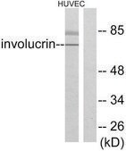 Anti-Involucrin antibody produced in rabbit affinity isolated antibody