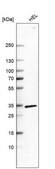 Anti-CCRL2 antibody produced in rabbit Prestige Antibodies® Powered by Atlas Antibodies, affinity isolated antibody, buffered aqueous glycerol solution