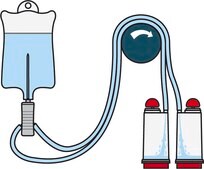 Steritest® NEO Device For liquids in ampoules and collapsible bags., Red base canister with single needle for easy access., pkg of 10 blisters per box, Single packed