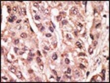 Anti-SUMO4 (V55 Mutant) antibody produced in rabbit saturated ammonium sulfate (SAS) precipitated, buffered aqueous solution