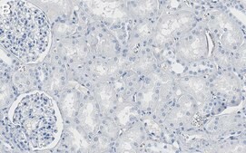 Anti-TRAF6 Antibody, clone 1M14 ZooMAb® Rabbit Monoclonal recombinant, expressed in HEK 293 cells