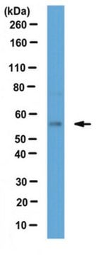 Anti-S1P lyase Antibody from rabbit, purified by affinity chromatography