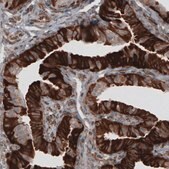 Monoclonal Anti-PDIA3 antibody produced in mouse Prestige Antibodies® Powered by Atlas Antibodies, clone CL2446, purified immunoglobulin, buffered aqueous glycerol solution