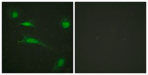 Anti-p53 antibody produced in rabbit affinity isolated antibody