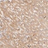 Anti-AGT antibody produced in rabbit Prestige Antibodies® Powered by Atlas Antibodies, affinity isolated antibody, buffered aqueous glycerol solution