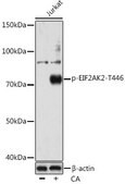 Anti-Phospho-PKR/EIF2AK2-T446 antibody produced in rabbit