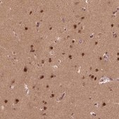 Anti-BRD9 antibody produced in rabbit Prestige Antibodies® Powered by Atlas Antibodies, affinity isolated antibody