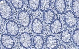 Anti-IQGAP1 Antibody, clone 4M20 ZooMAb® Rabbit Monoclonal recombinant, expressed in HEK 293 cells