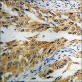 Anti-phospho-eIF2 α (pSer51) antibody produced in rabbit affinity isolated antibody