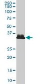 Monoclonal Anti-AKR1B10 antibody produced in mouse clone 2B3, purified immunoglobulin, buffered aqueous solution