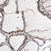 Monoclonal Anti-ITGB3 antibody produced in mouse Prestige Antibodies® Powered by Atlas Antibodies, clone CL7319, purified immunoglobulin, buffered aqueous glycerol solution