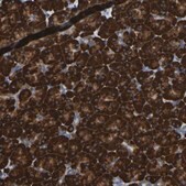 Anti-P4HB antibody produced in rabbit Prestige Antibodies® Powered by Atlas Antibodies, affinity isolated antibody, buffered aqueous glycerol solution
