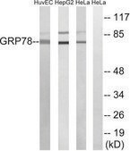 抗-GRP78 兔抗 affinity isolated antibody