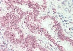 Anti-ST6GALNAC1 antibody produced in rabbit affinity isolated antibody