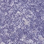 Anti-IGSF1 antibody produced in rabbit Prestige Antibodies® Powered by Atlas Antibodies, affinity isolated antibody, buffered aqueous glycerol solution