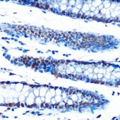 Anti-ADAR1 antibody produced in rabbit