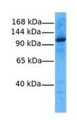 Anti-RNF31 antibody produced in rabbit affinity isolated antibody
