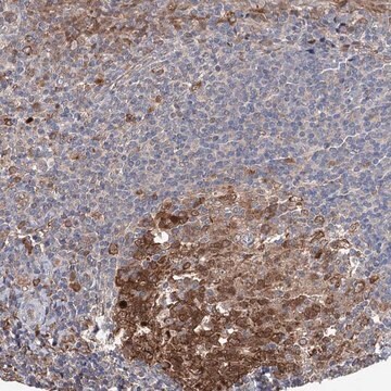 Anti-NCAPD2 antibody produced in rabbit Prestige Antibodies® Powered by Atlas Antibodies, affinity isolated antibody, buffered aqueous glycerol solution