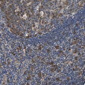 Anti-PPP2R1B antibody produced in rabbit Prestige Antibodies® Powered by Atlas Antibodies, affinity isolated antibody, buffered aqueous glycerol solution