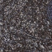 Anti-SMARCB1 antibody produced in rabbit Prestige Antibodies® Powered by Atlas Antibodies, affinity isolated antibody, buffered aqueous glycerol solution