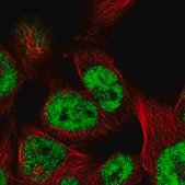 Anti-TCEAL8 antibody produced in rabbit Prestige Antibodies® Powered by Atlas Antibodies, affinity isolated antibody, buffered aqueous glycerol solution