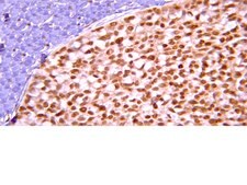 Anti-ARF1 Antibody, clone 3F1 clone 3F1, from mouse