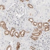 Anti-MUC1 antibody produced in rabbit Prestige Antibodies® Powered by Atlas Antibodies, affinity isolated antibody, buffered aqueous glycerol solution