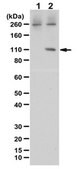 Anti-phospho-STAT2 (Tyr689) Antibody from rabbit, purified by affinity chromatography