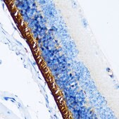 Anti-Rhodopsin Antibody, clone 5N3G9, Rabbit Monoclonal