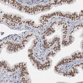 Anti-BUB3 antibody produced in rabbit Prestige Antibodies® Powered by Atlas Antibodies, affinity isolated antibody, buffered aqueous glycerol solution