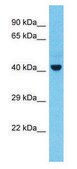 Anti-TSG101 (N-terminal) antibody produced in rabbit affinity isolated antibody