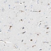 Anti-CD74 antibody produced in rabbit Prestige Antibodies® Powered by Atlas Antibodies, affinity isolated antibody, buffered aqueous glycerol solution