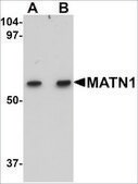 Anti-MATN1 antibody produced in rabbit affinity isolated antibody, buffered aqueous solution, ab1