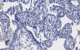 Anti-ATG7 Antibody, clone 1E15 ZooMAb® Rabbit Monoclonal recombinant, expressed in HEK 293 cells