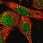 Anti-TRIM8 antibody produced in rabbit Prestige Antibodies® Powered by Atlas Antibodies, affinity isolated antibody, buffered aqueous glycerol solution, ab2