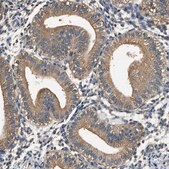 Anti-PPP2R1B antibody produced in rabbit Prestige Antibodies® Powered by Atlas Antibodies, affinity isolated antibody, buffered aqueous glycerol solution