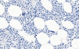 Anti-p38α/SAPK2A Antibody, clone 1O11 ZooMAb® Rabbit Monoclonal recombinant, expressed in HEK 293 cells