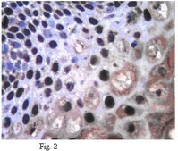 抗Twist1（扭曲相关蛋白1）抗体 from rabbit, purified by affinity chromatography
