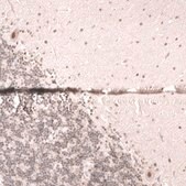 Monoclonal Anti-Smarcb1 Antibody Produced In Mouse Prestige Antibodies® Powered by Atlas Antibodies, clone CL14017, affinity isolated antibody, buffered aqueous glycerol solution