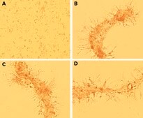 Lyo ECM Gel lyophilized powder, BioReagent, suitable for cell culture