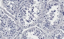 Anti-CBP Antibody, clone 3N20 ZooMAb® Rabbit Monoclonal recombinant, expressed in HEK 293 cells