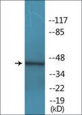 Anti-phospho-p53 (pSer392) antibody produced in rabbit affinity isolated antibody