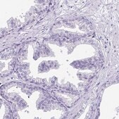 Anti-PRM2 antibody produced in rabbit Prestige Antibodies® Powered by Atlas Antibodies, affinity isolated antibody, buffered aqueous glycerol solution