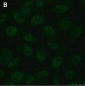 Anti-Notch1 Antibody, clone 1A32 ZooMAb® Rabbit Monoclonal recombinant, expressed in HEK 293 cells